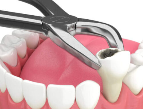 The Importance of General Dentistry: Your Gateway to Lifelong Oral Health